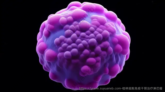 桂林细胞免疫干预治疗淋巴瘤