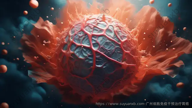 广州细胞免疫干预治疗胃癌